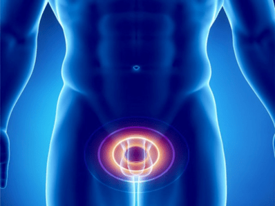 Prostatitis - vnetje prostate pri moških